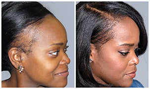 Jaysuing Hair Serum
